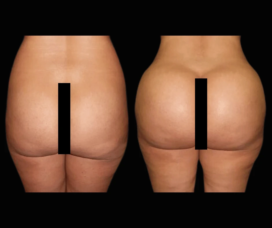 BBL Results Dr. Greenberg 6