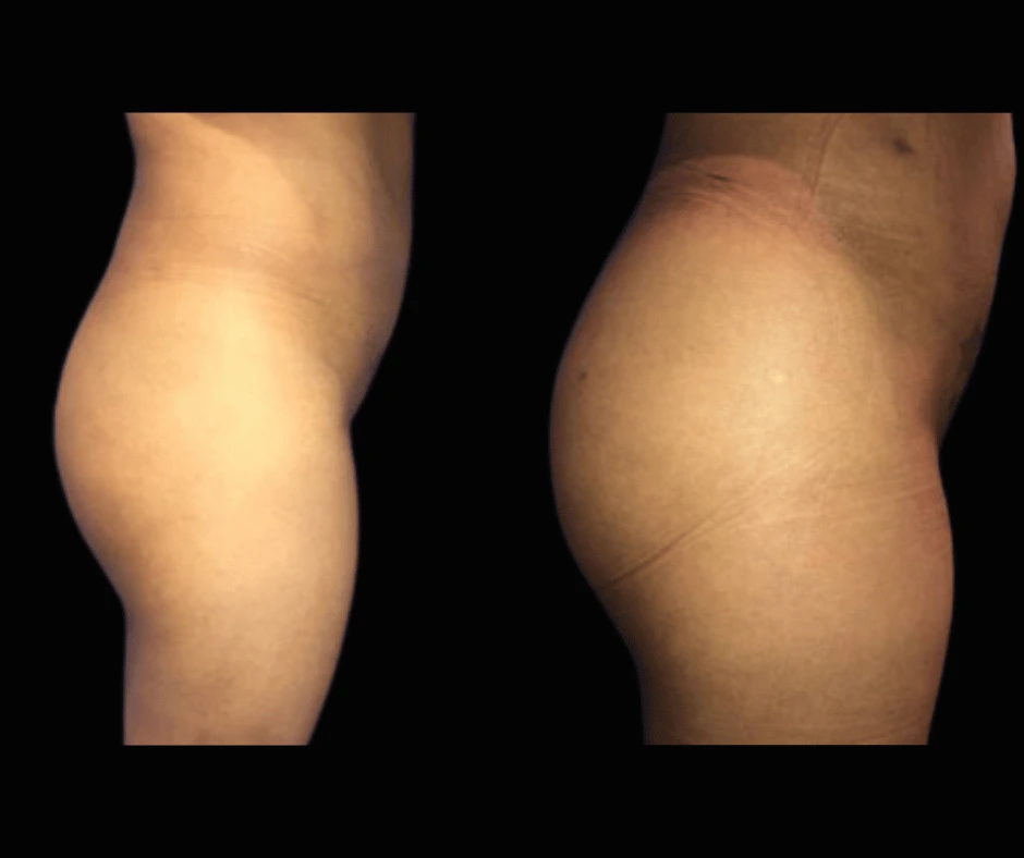 BBL Results Dr. Greenberg 4