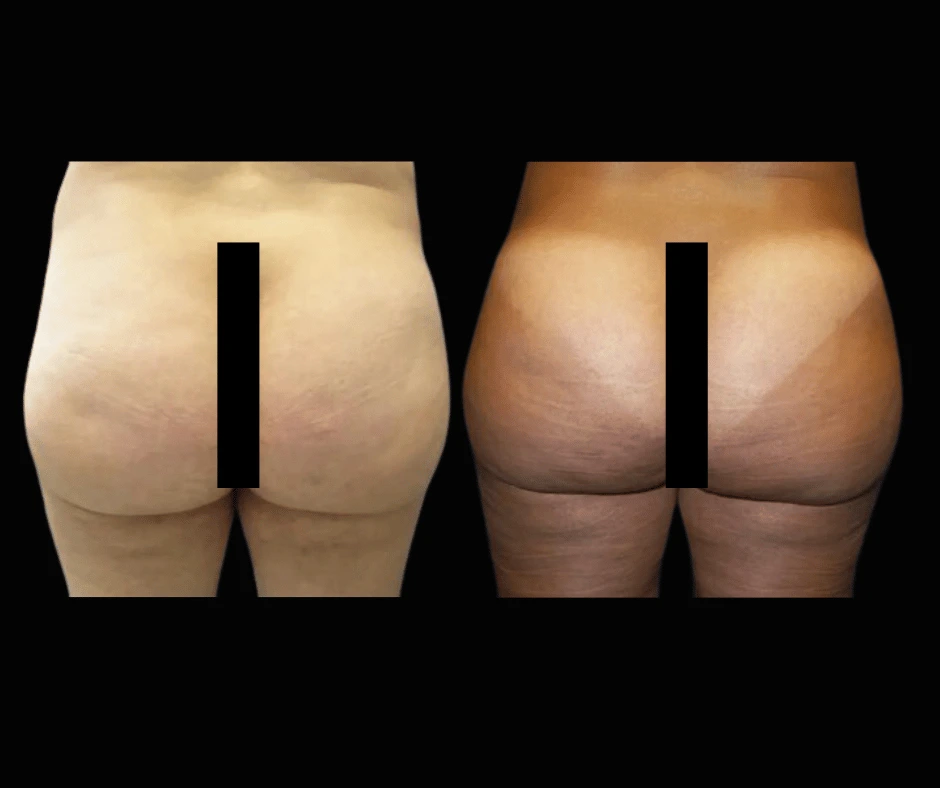 BBL Results Dr. Greenberg 3