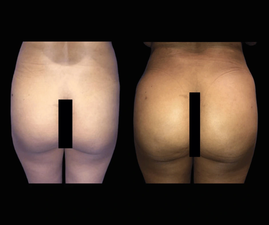 BBL Results Dr. Greenberg 1