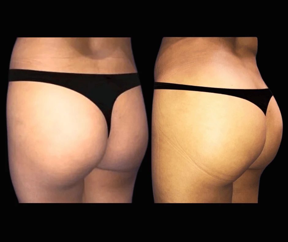 BBL Results Dr. Greenberg